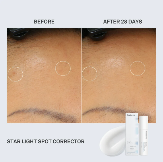 New serum for dark spots